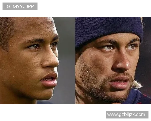 男足球明星整形吗